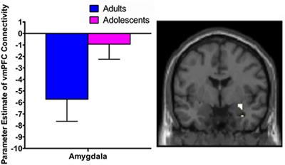 Prefrontal-Amygdala Connectivity and State Anxiety during Fear Extinction Recall in Adolescents